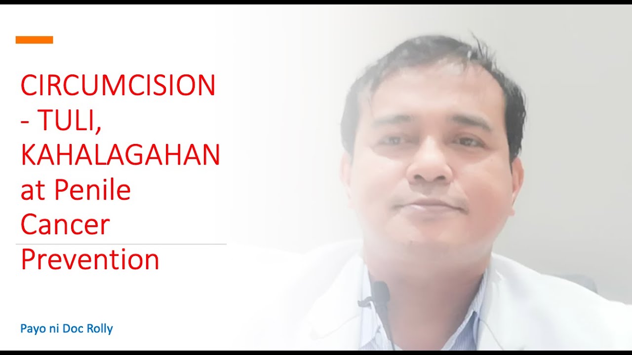 Putar video Circumcision- Tuli, Kahalagahan at Penile Cancer Prevention sekarang Circumcision- Tuli, Kahalagahan at Penile Cancer Prevention