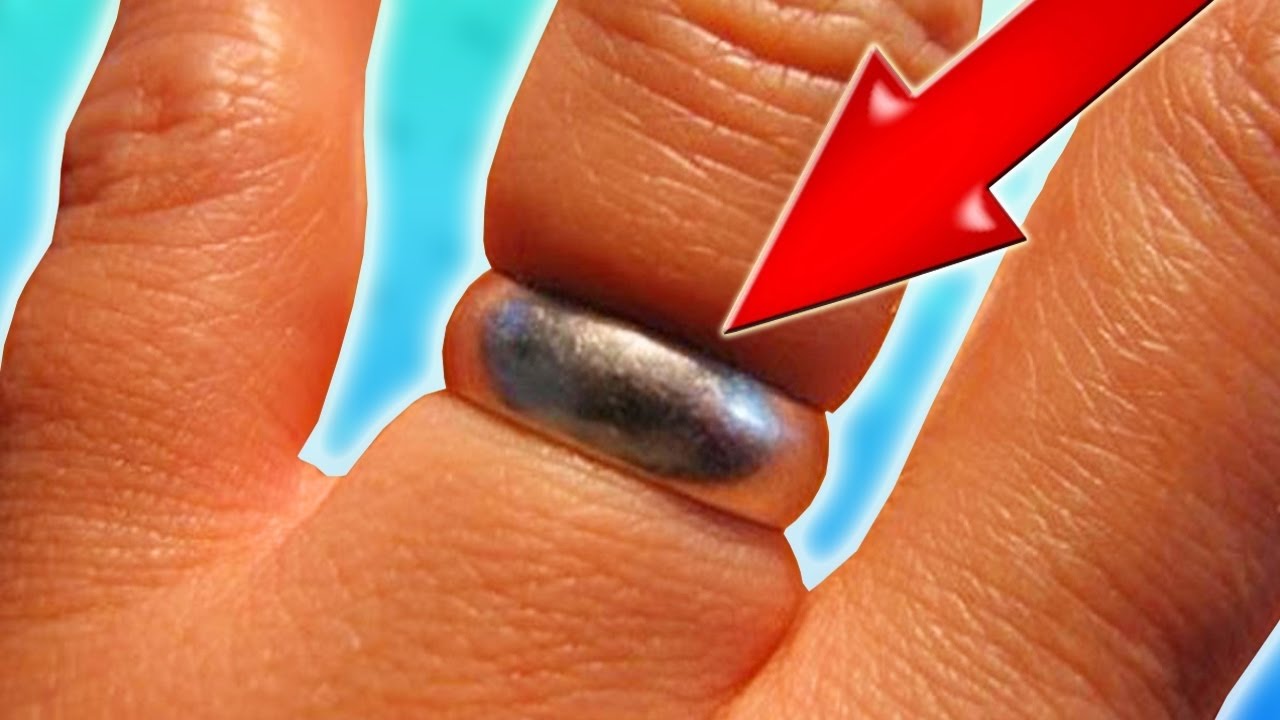 Lifehack. How to remove a ring from swollen finger