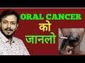 ORAL CANCER COMPLETE INFORMATION IN HINDI