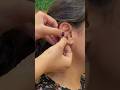 Cervical Pain Neck Pain Shoulder Pain Acupressure Point Muskanrana Yoga