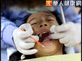 不麻煩！兒童免費塗氟不用到診所