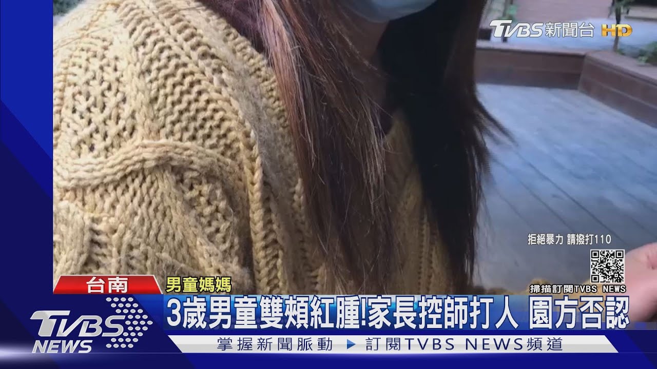 3歲男童雙頰紅腫！　家長控師打人園方否認