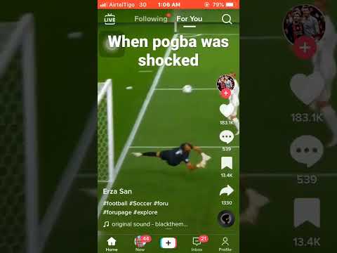 When pogba was shocked By Portugal Goalkeeper Massive performance 😘