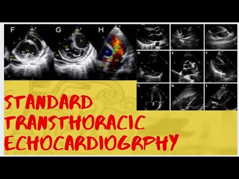 #ECHOCARDIOGRAPHY_MADE_EASY. How To perform Standard transthoracic Echo by EACVI