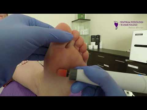 Pierwsza wizyta u podologa