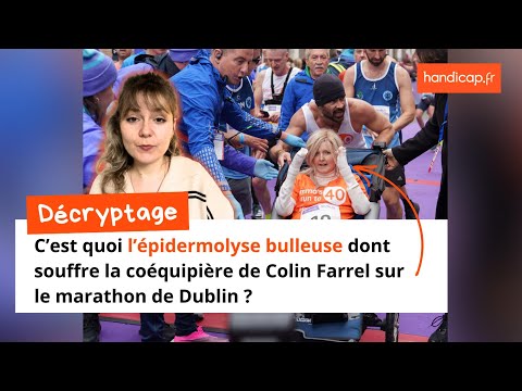 C'est quoi l'épidermolyse bulleuse ?