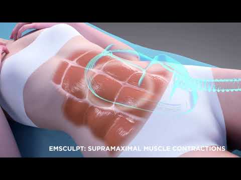 How it works: EMSculpt on the Abdomen