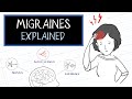 What Are Migraines HealthSketch