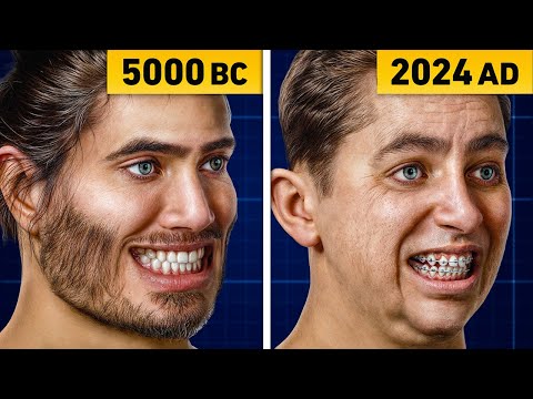 Why Your Ancestors Didn't Need Braces