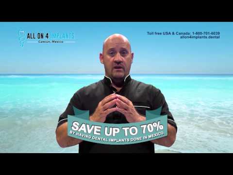 CHEAP DENTAL IMPLANTS MEXICO 😀 All on 4: Most advanced technology in dental implants at great price