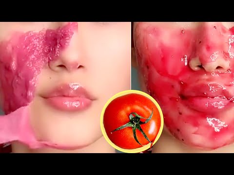Vitamin C Face Mask to remove dark spots and pigmentation | Vitamin C to remove dark circles
