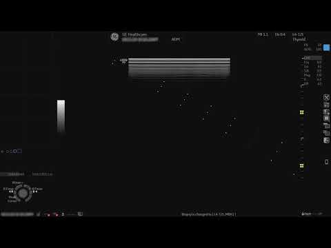 LOGIQ P9 Tutorials: Biopsy Kit