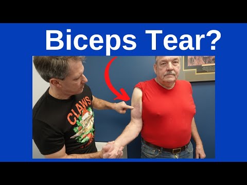 Biceps Tendon Rupture-Signs and Symptoms