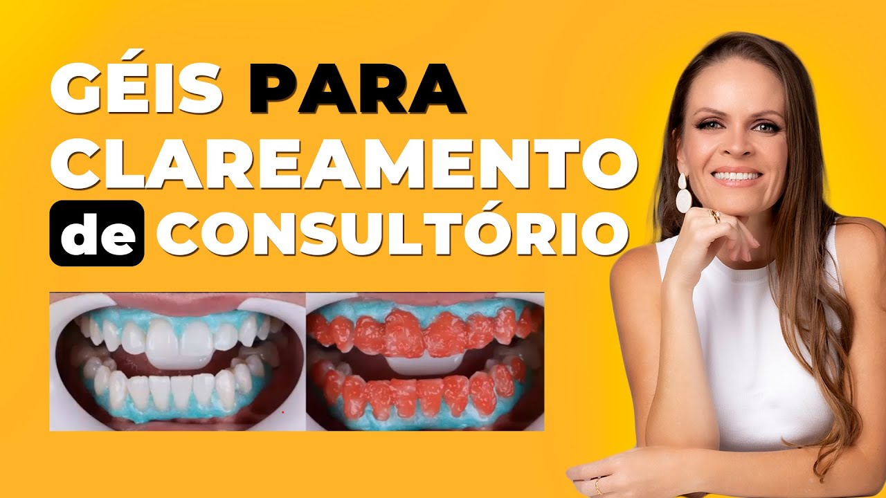 Qual Gel clareador utilizar no clareamento de consultório em 2024?