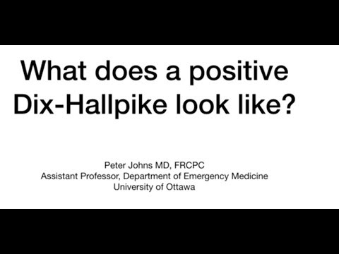 What does a positive Dix-Hallpike look like?