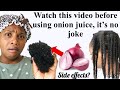 WATCH This VIDEO BEFORE YOU USE ONION JUICE Side Effects Of Using ONION JUICE On Natural Hair