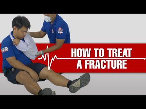 How to Give First Aid and Treat a Fracture