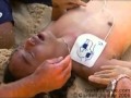 Agonal Gasps Bondi Beach Rescue