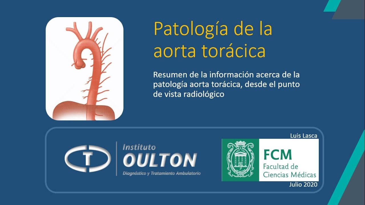 Patología aórtica torácica