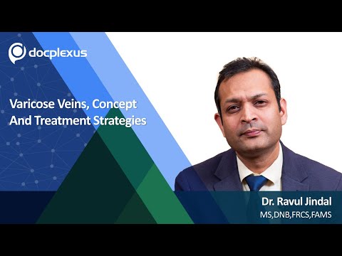Varicose Veins, Concept And Treatment Strategies