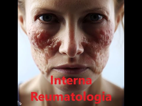 , title : 'Interna Szczeklika ➡ Reumatologia (streszczenie)'