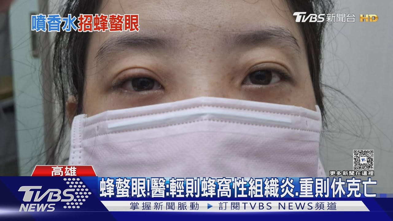 香水太香? 戴全罩式安全帽仍遭蜂螫 正妹視力驟降剩0.7