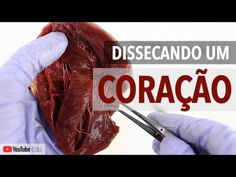 Dissecting a Heart! Cardiac Anatomy | Anatomy and etc.