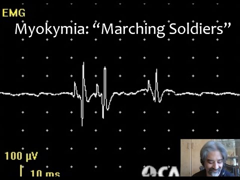 GMNR Legacy Series: EMG Waveform Recognition Workshop