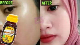 Download lagu Wajah Keriput dan Kusam Akan Kembali Putih Seperti Remaja Lagi || Dodi Satria mp3
