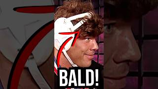 What Happened After Kurt Angle Got His Head Shaved?!