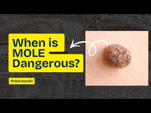 When is Mole Dangerous?