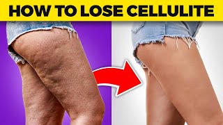 How to Lose Cellulite