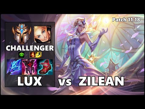 CHALLENGER Support Gameplay - LUX vs ZILEAN Patch 11.18