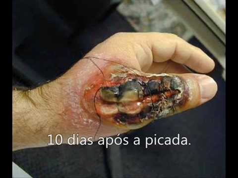 Os círculos escuros abaixo de olhos da razão e como livrar-se