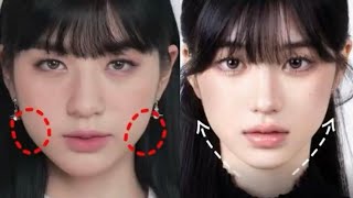 MASSETER BOTOX EFFECT | ideal jawline + v-line face + facial symmetry 