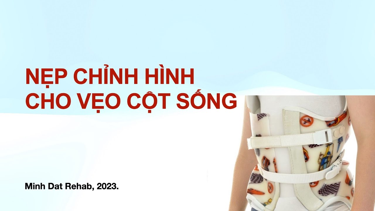 Nẹp chỉnh hình cho vẹo cột sống