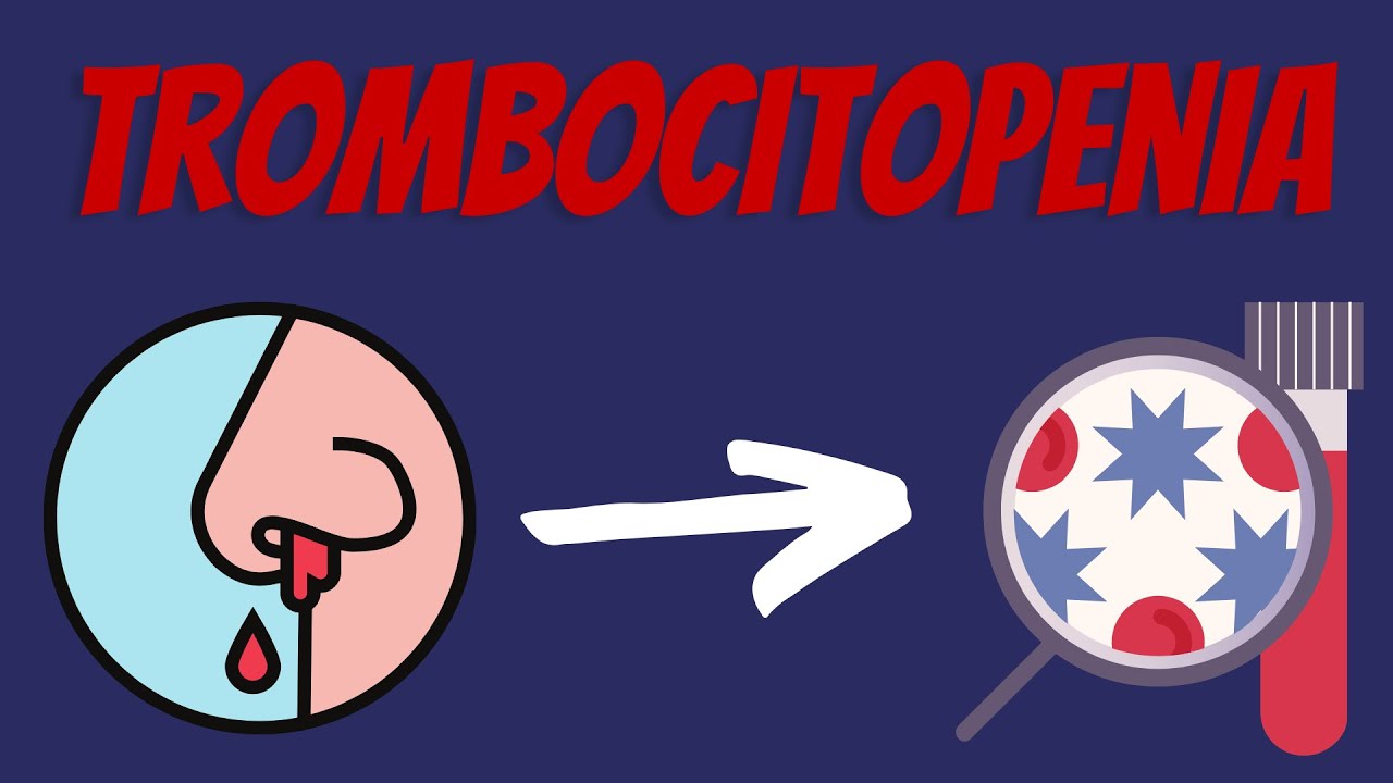 Trombocitopenia Explicada Claramente