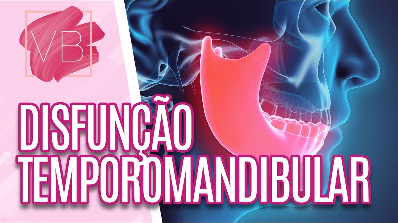 Disfunção temporomandibular: o que é, sintomas e tratamentos - Você Bonita (30/06/2022)