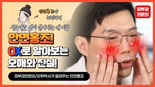안면홍조 판단 기준! 잘못된 상식 오늘 확실하게 찝어드려요!#홍조개선꿀팁 #홍조치료