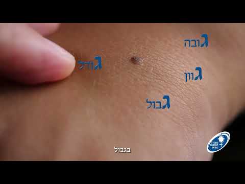 2,130 נשים וגברים חולים חדשים עם מלנומה
