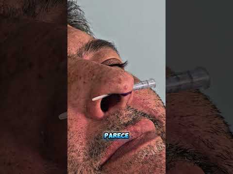 Septum Piercing Sin Dolor