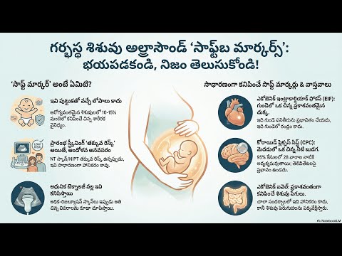 Soft Markers — video thumbnail