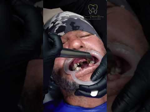 video 8B0bbso6bx0