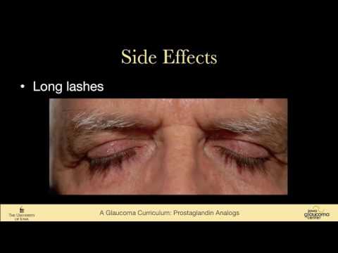 36 MEDICAL MANAGEMENT Prostaglandin Analogs