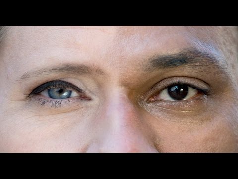 Handgelenksfläche Knochen Was mit dem Schäden an den Gelenken zu tun