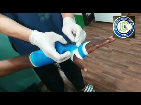 Below elbow Plastering | Isolated Radius, follow up | BE cnversn from AE | Fiberglass plastr Adamya