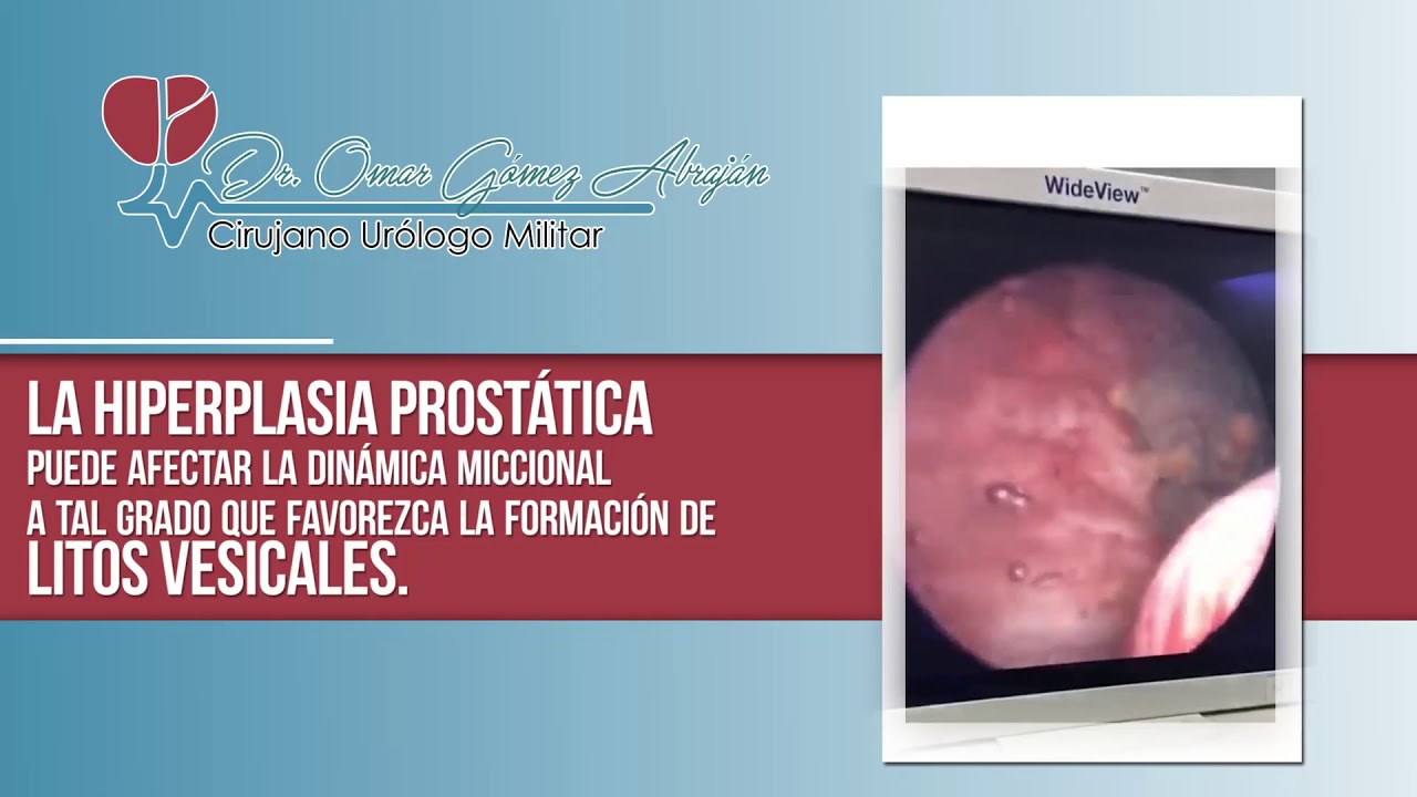 Omar Gómez Abraján-8