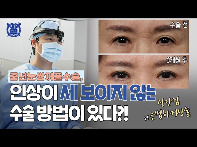 눈·코·재수술은 시우성형외과 눈·코·재수술은 시우성형외과