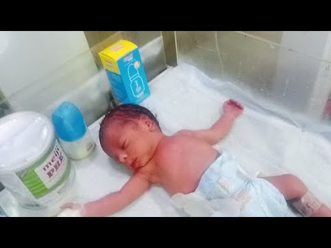 A Premature Cute Babys First Formula Feeding Preparation | Tiny Fighter Early Nutrition Journey NICU