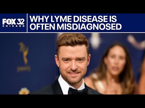 Justin Timberlake has Lyme disease: why it's commonly misdiagnosed